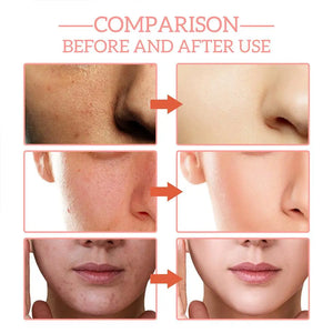 Sérum Visage 5-en-1 Anti-Âge – Vitamine C, Hydratant, Raffermissant & Réducteur de Pores