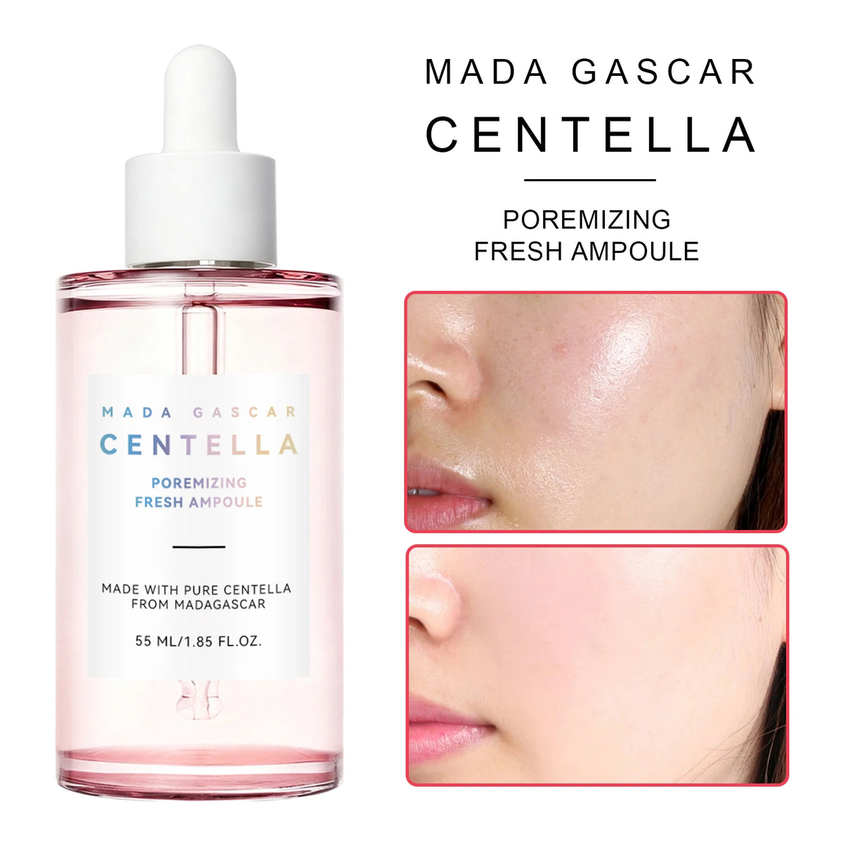 Sérum Centella & Niacinamide — Éclat, Hydratation & Soin Anti-Imperfections