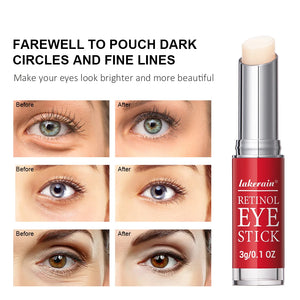 Stick Contour des Yeux au Rétinol – Anti-Cernes, Anti-Poches, Anti-Rides & Hydratant