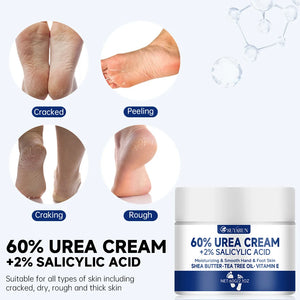 Crème Pieds 60% Urée – Anti-Talons Fissurés, Hydratation Intense & Élimination des Callosités