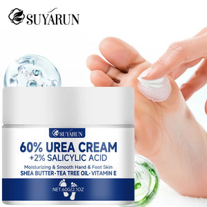 Crème Pieds 60% Urée – Anti-Talons Fissurés, Hydratation Intense & Élimination des Callosités